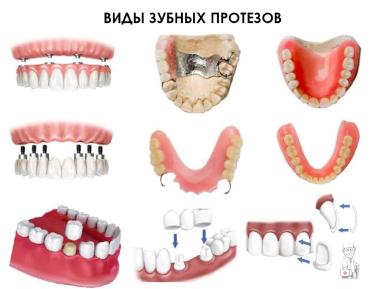 protez-types.jpg protez-types.jpg